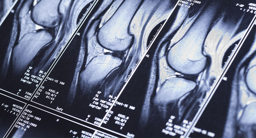Data Is King: Medical Imaging Is the Key to Unlocking Orthopedics’ Next Era